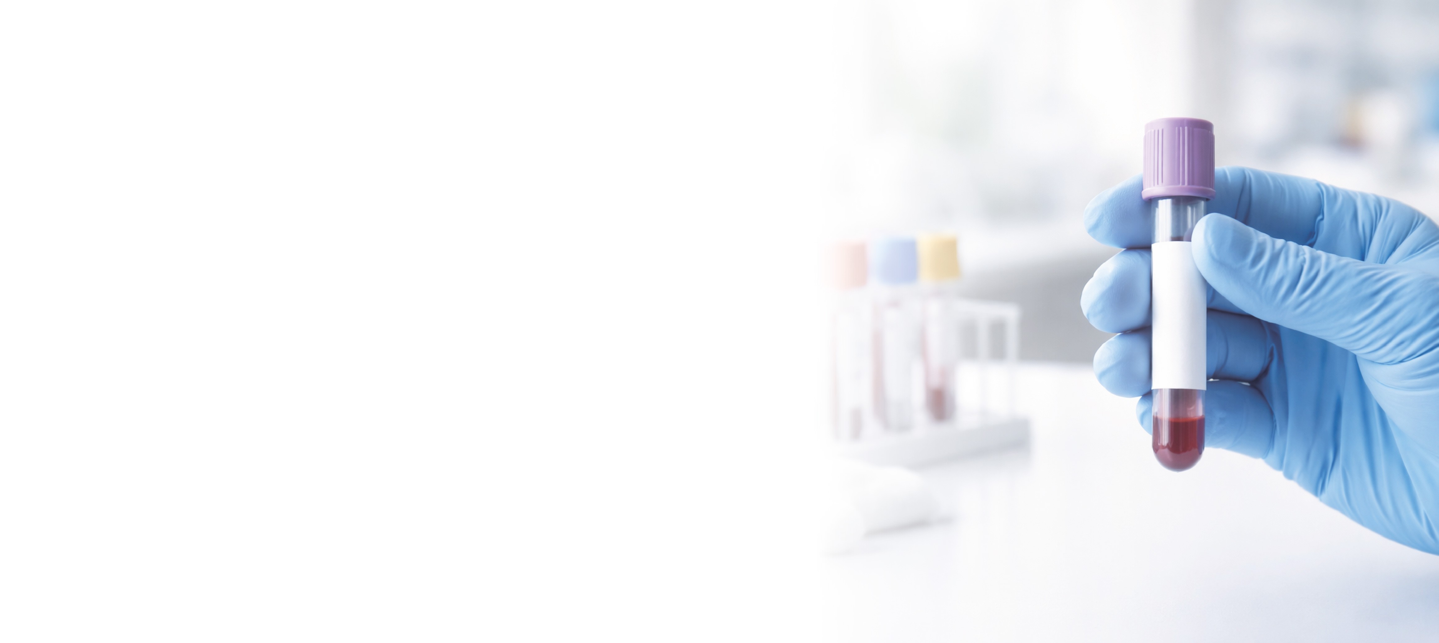 Tubos de muestras de laboratorio